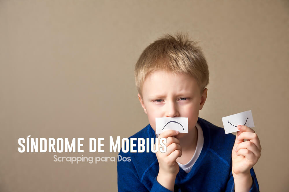 síndrome de Moebius